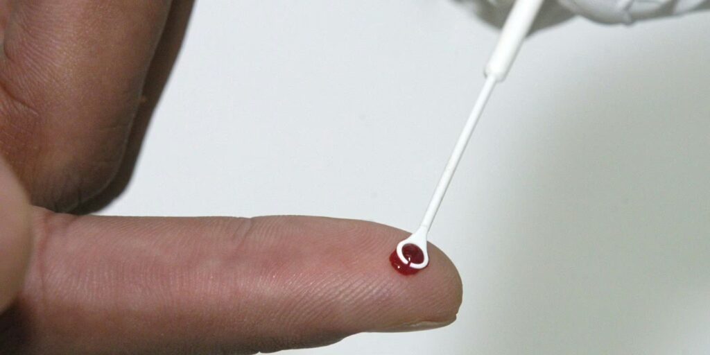 Fiji declara emergência nacional por HIV com 1 caso a cada 60 pessoas