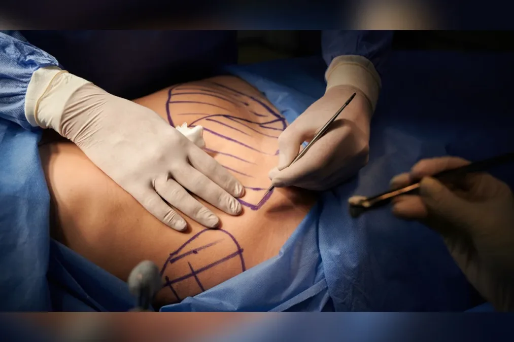 Justiça suspende médico de BH investigado por possíveis erros em cirurgias