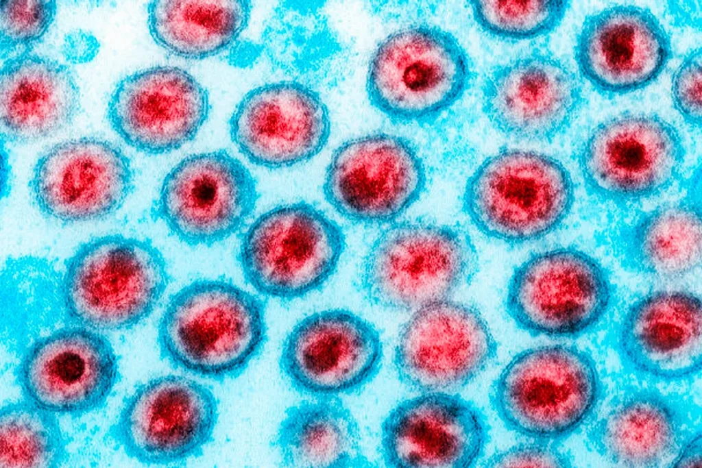 Medicamento de câncer reduz células infectadas por HIV em estudo